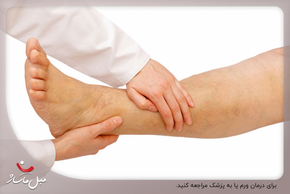 مشورت با پزشک؛ اولین قدم برای درمان ورم پا